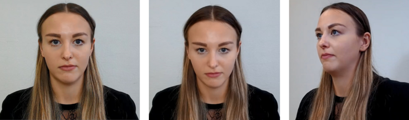 (öffnet Vergrößerung des Bildes) Aus den Studien, v.l.n.r.: Blickkontakt ohne Abweichung, mit vertikaler Abweichung, mit horizontaler Abweichung (öffnet Vergrößerung des Bildes)