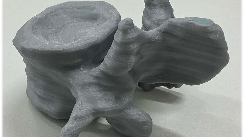 3D-gedruckter Wirbel